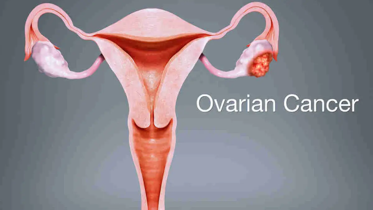 Gastrointestinal Cancer